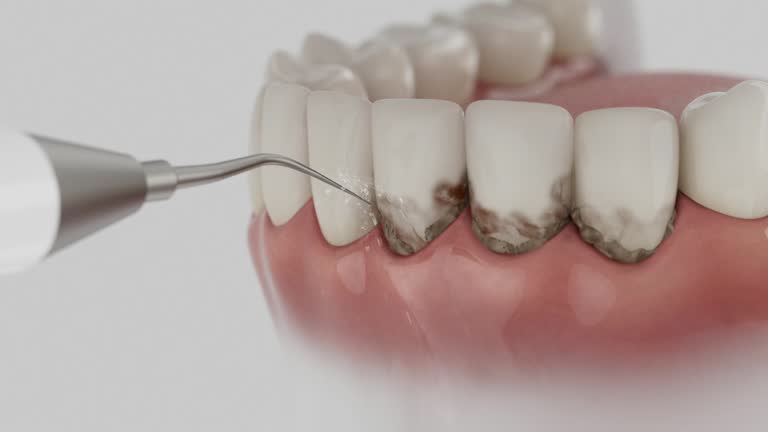 Trusted Dental Implants service in Danville, IL - Dentist Open Now